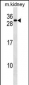 REEP5 Antibody (C-term)